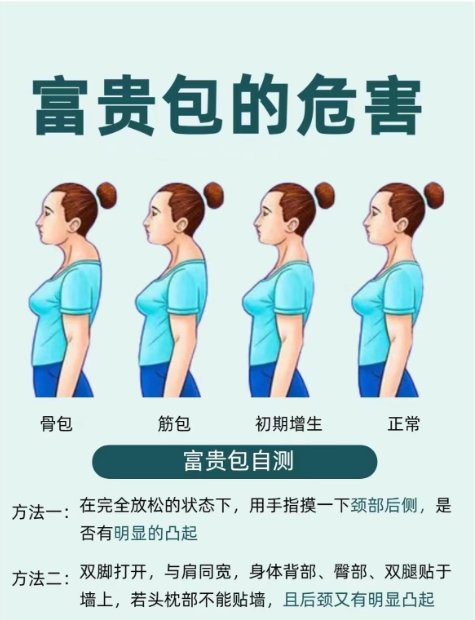 005bef71c0de3865bb4523fd488f9fc4.png